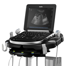 SonoSite EDGE II Portable Ultrasound Machine